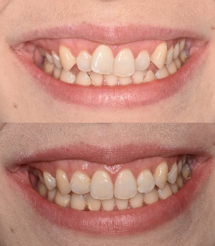 Jane : orthodontics