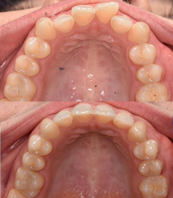 Sam : Orthodontics